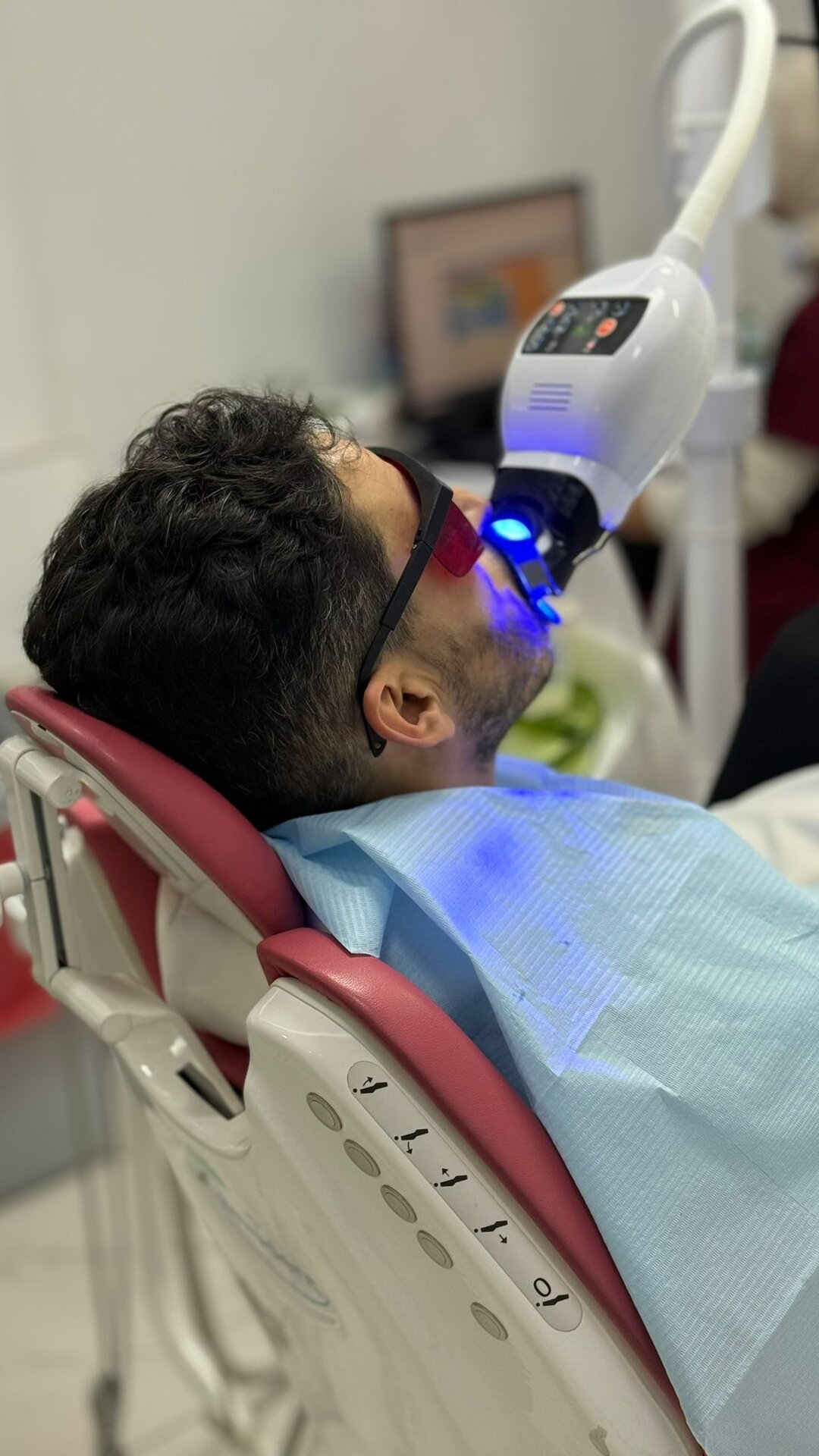 Antes del tratamiento dental