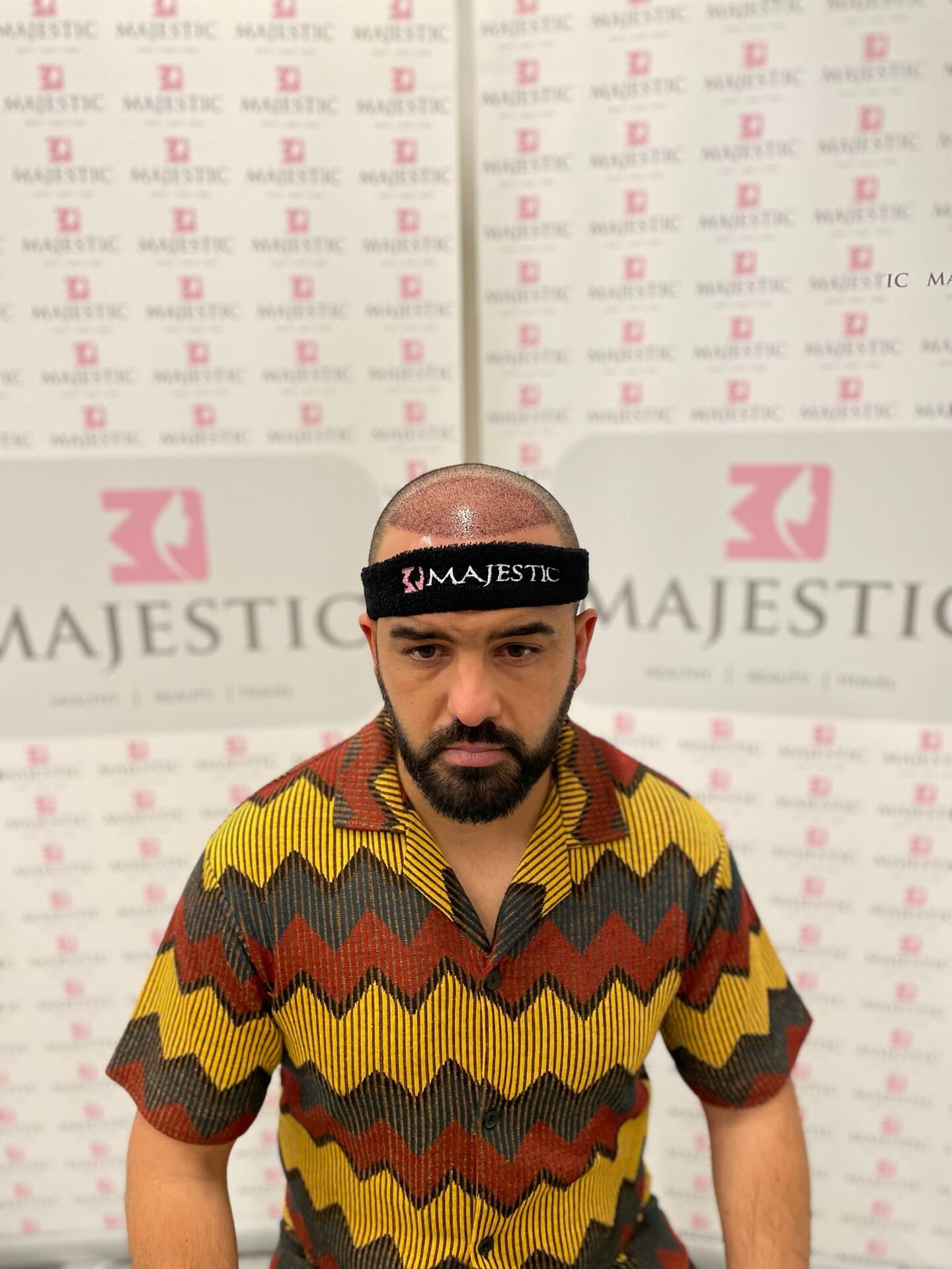 Conception de la racine des cheveux