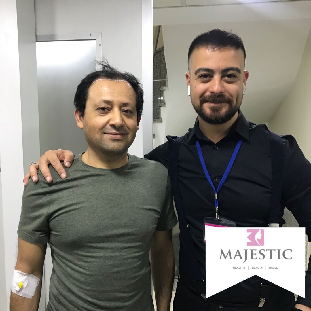 Hair Transplant Result