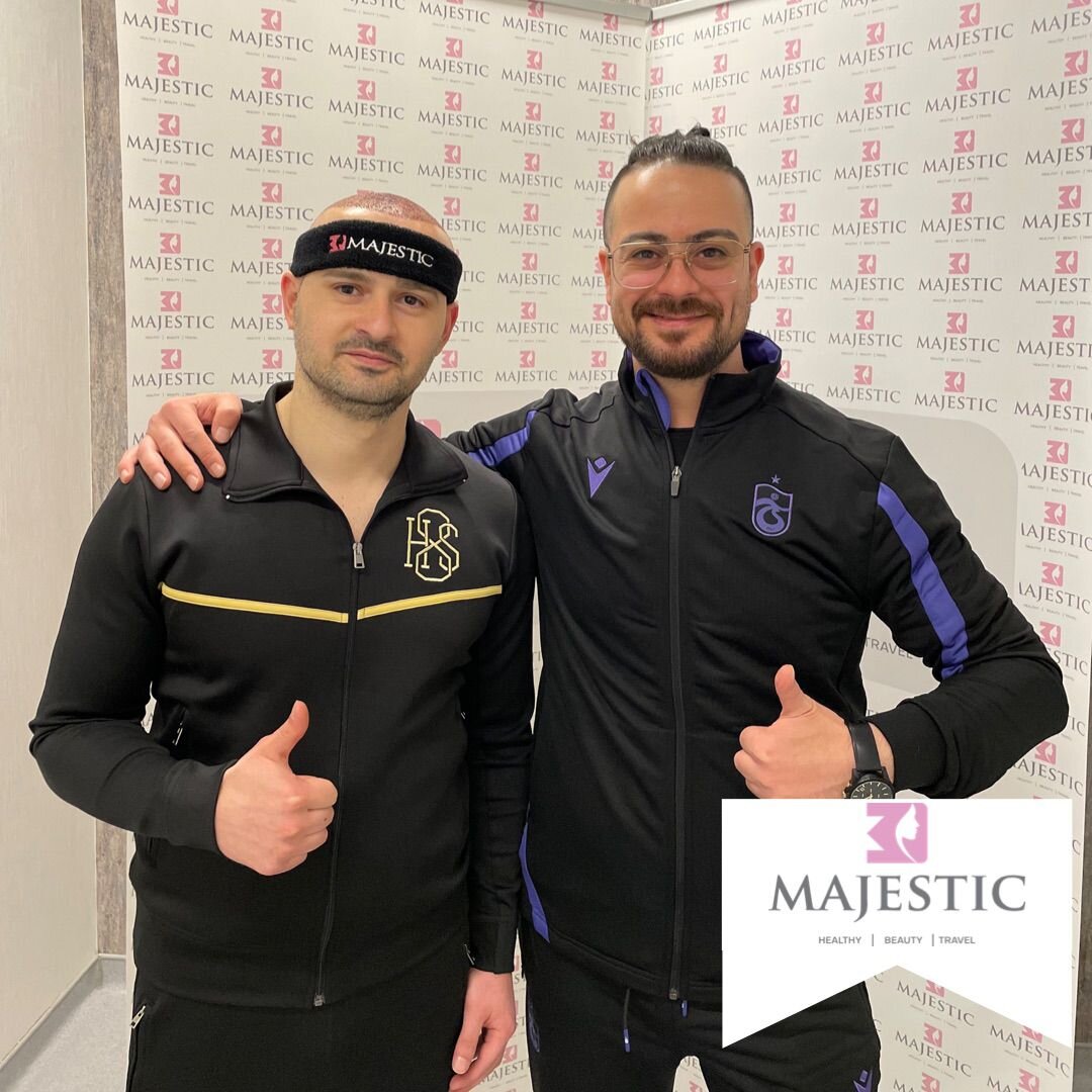 DHI Hair Transplant Result